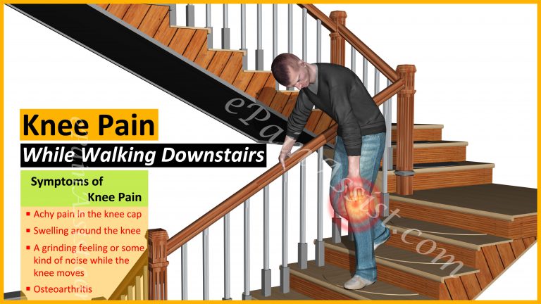 Knee Pain While Walking Downstairs: Causes, Treatment, Exercises