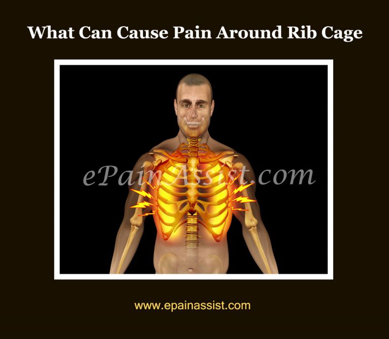 Pain Around Rib Cage: Causes, Symptoms, Treatment Complications