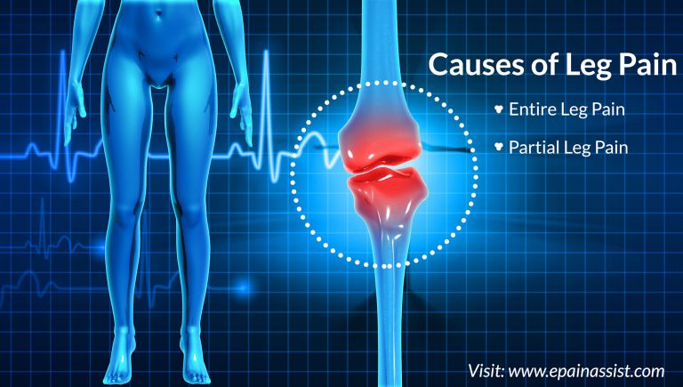 Leg Pain: Causes of Entire Leg Pain, Partial Leg Pain and Lower Leg Pain