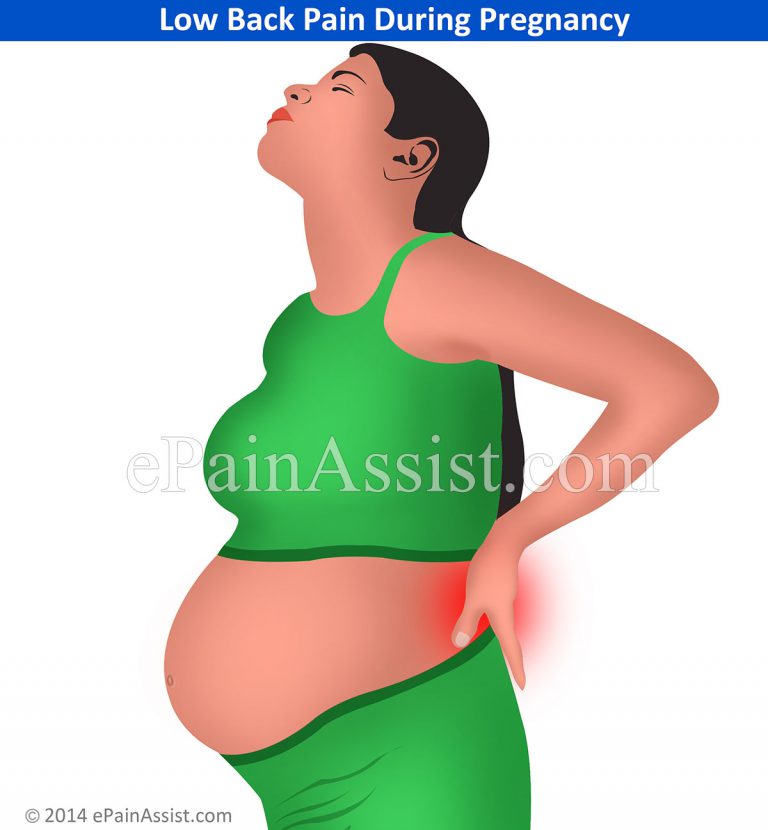 Low Back Pain During Pregnancy: Causes, Symptoms, Treatment, Prevention