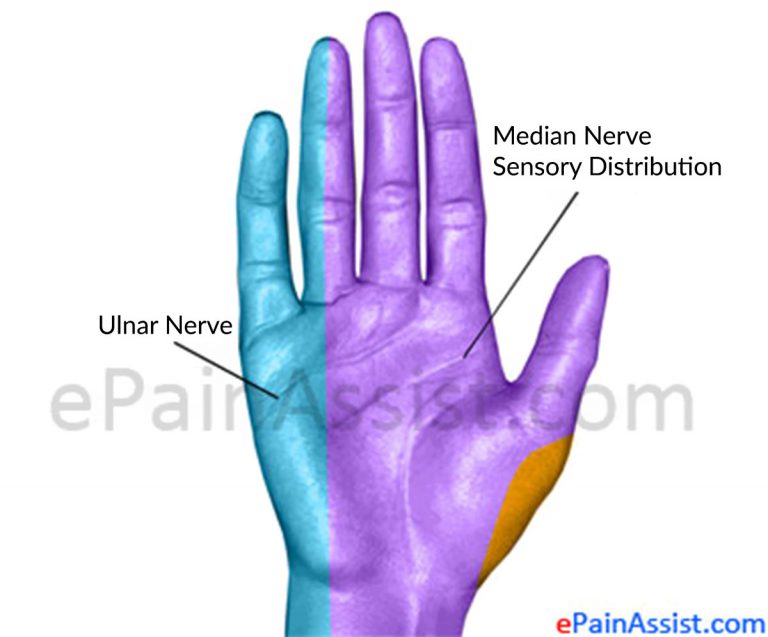 Median Nerve Injury: Symptoms- Numbness, Weak Grip, Treatment- R.I.C.E, Surgery