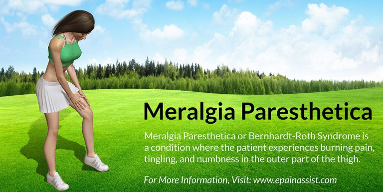 Meralgia Paresthetica: Treatment, Exercises, Causes, Symptoms, Signs, Investigations, Risk Factors, Etiology