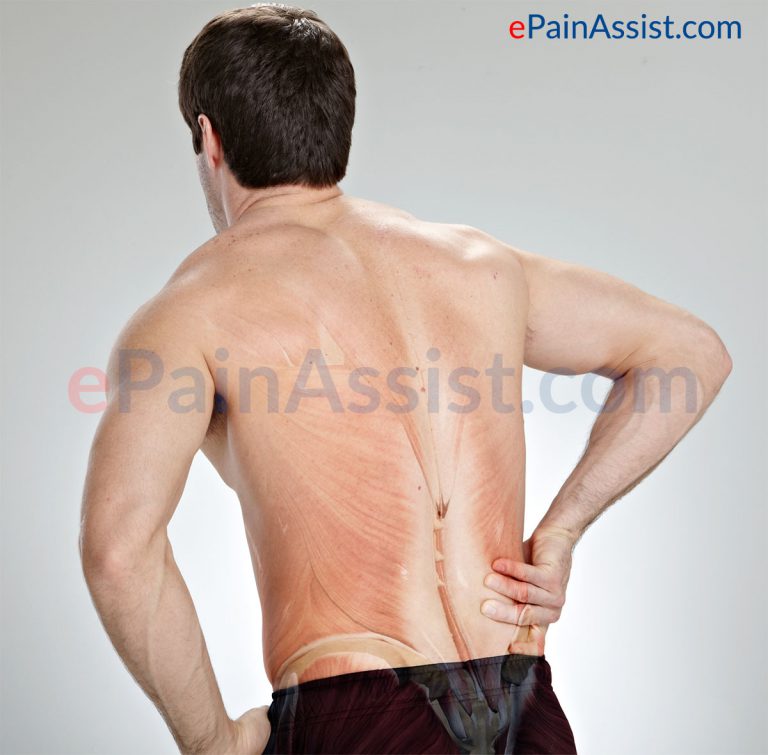 Q and A on Disabling Low Back Pain Due To Muscle Spasm or Tense Back Muscles or Facet Joint Pain