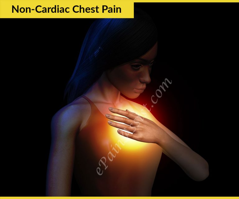 Non-Cardiac Chest Pain: Causes, Symptoms, Treatment