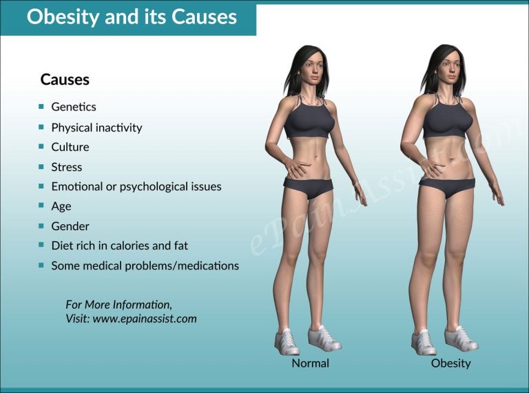 Causes of Infertility: Impact of Obesity on Fertility in Men & Women