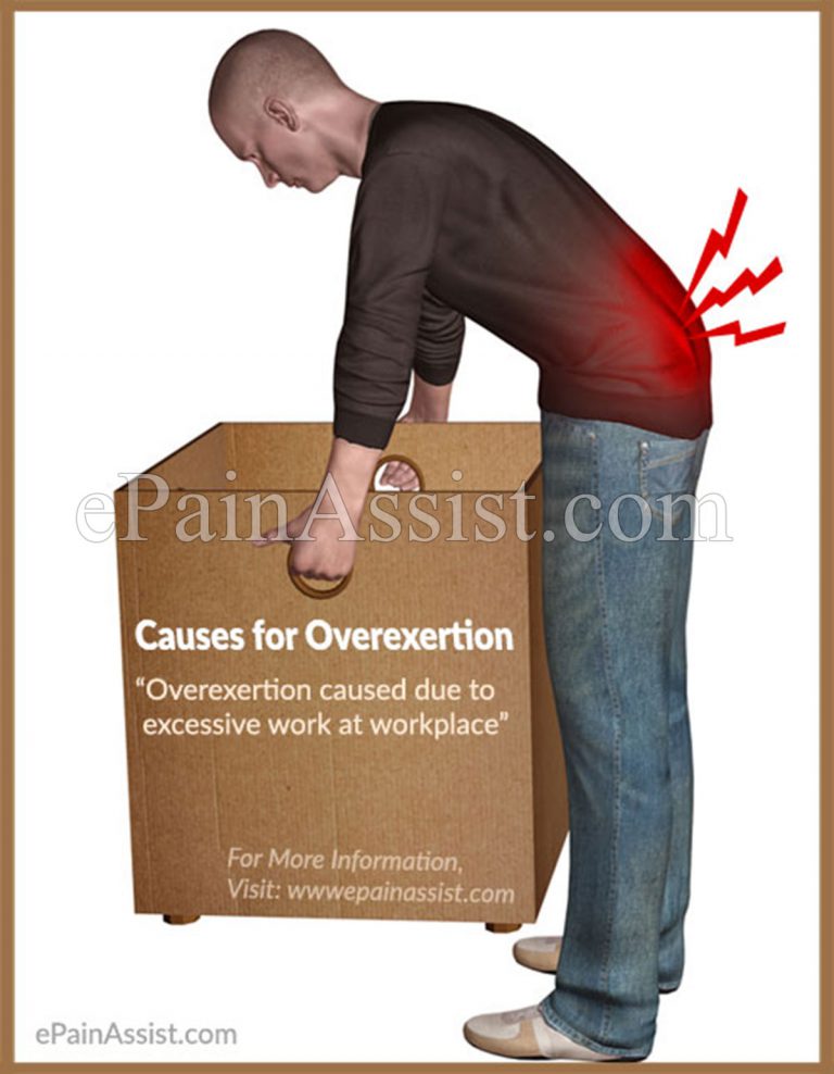 Overexertion: Signs, Symptoms, Causes, Treatment, Prevention