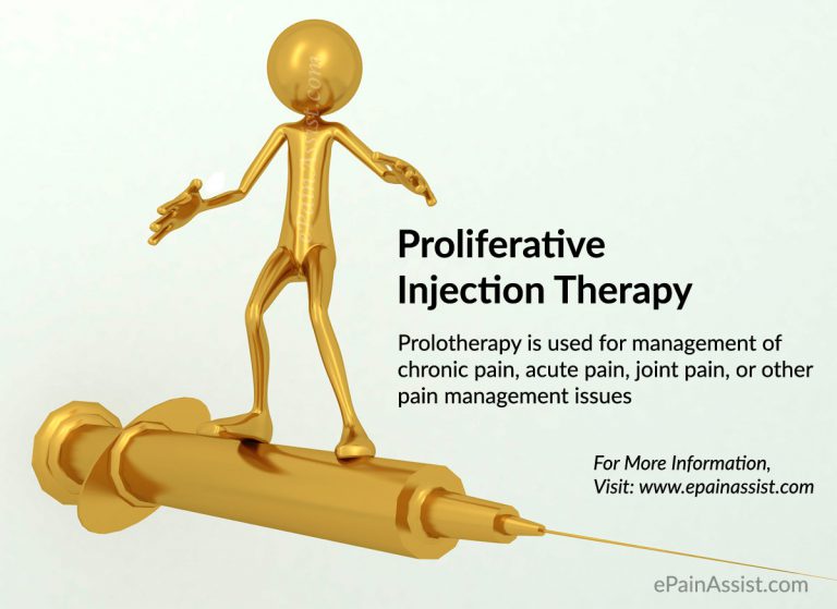 Prolotherapy or Proliferation Therapy or Proliferative Injection Therapy: Uses, Side Effects, Benefits