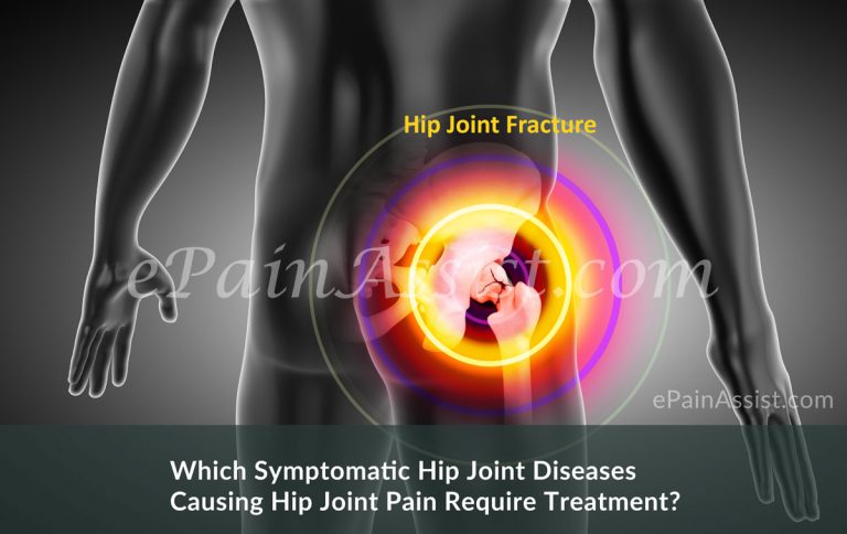 Q&A: Hip Joint Pain Treatment Approach and Options–Everything You Need To Know