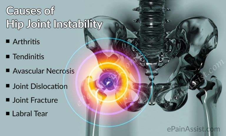 What Can Cause Hip Joint Pain and How Is It Diagnosed?