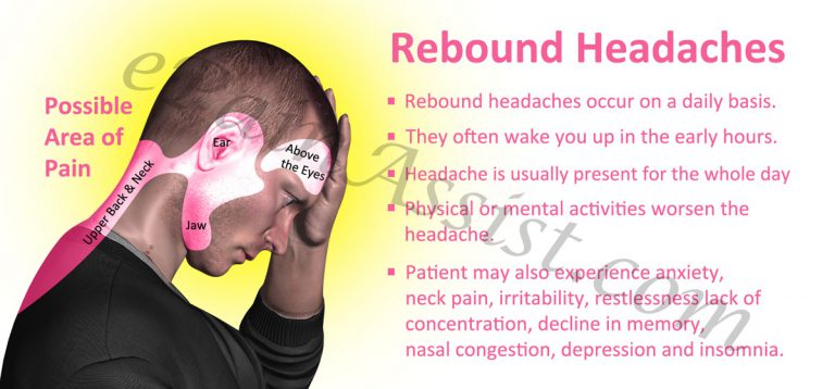 Rebound Headaches or Medication-Overuse Headaches: Causes, Risk Factors, Signs, Symptoms, Treatment