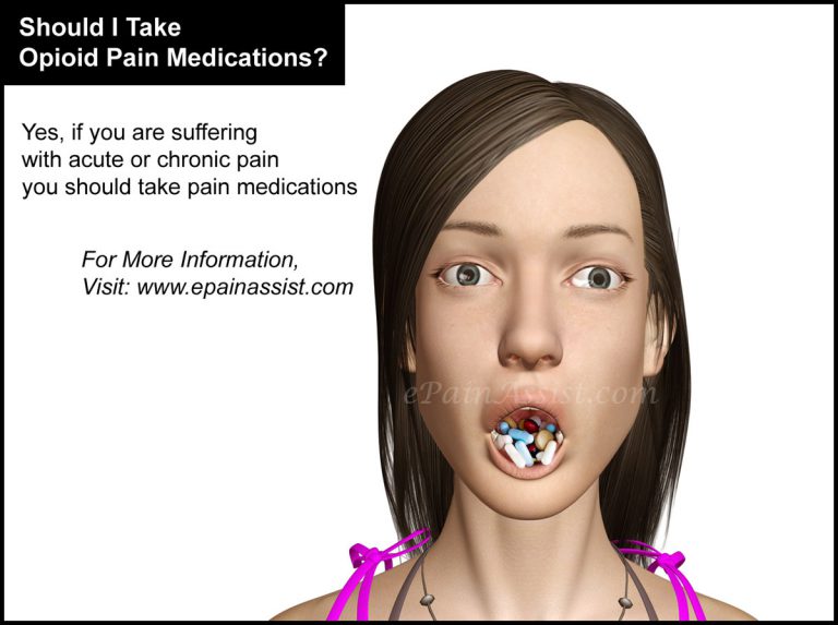Q and A: Should I Take Opioid Pain Medications? Pseudoaddiction, Anxiety Disorder