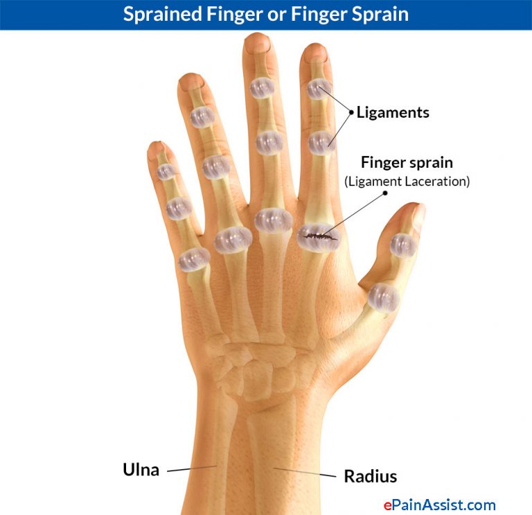 Sprained Thumb or Skier’s Thumb: Types, Causes, Signs, Symptoms, Treatment, Exercises