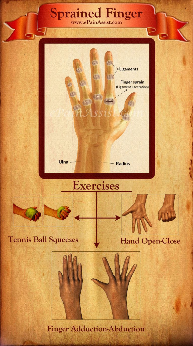 Sprained Finger or Finger Sprain: Types, Causes, Signs, Symptoms, Treatment, Exercises