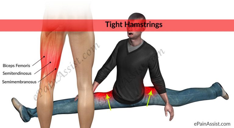 Tight Hamstrings: Stretches To Loosen Stiff Hamstring Muscles