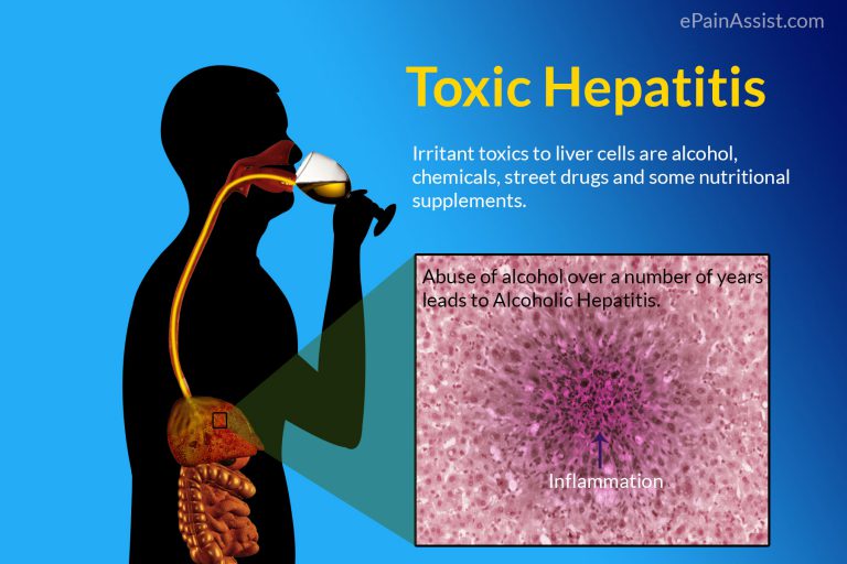 Toxic Hepatitis: Definition, Causes, Risk Factors, Symptoms, Complications, Diagnosis, Treatment