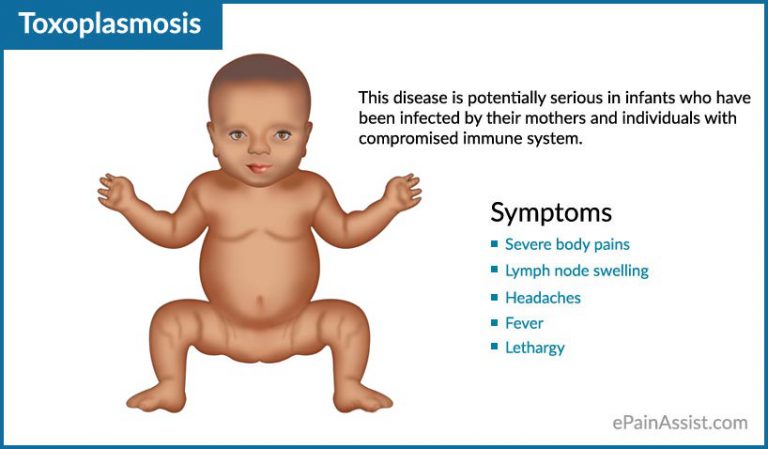 Toxoplasmosis in Human: Causes, Symptoms, Diagnosis, Treatment