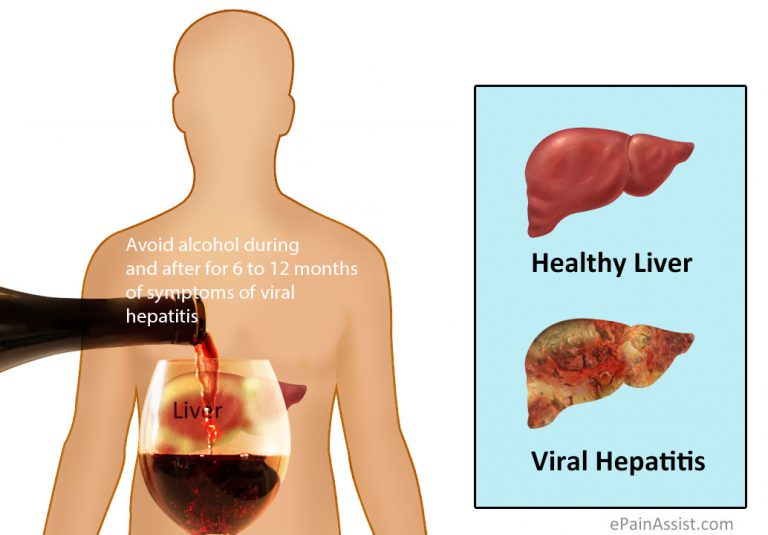 Viral Hepatitis: A, B, C, Definition, Causes, Symptoms, Phases of Clinical Manifestations, Diagnosis, Treatment