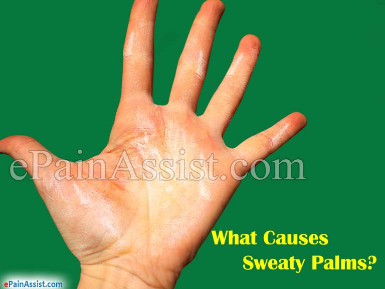 What Causes Sweaty Palms & How to Get Rid of it?