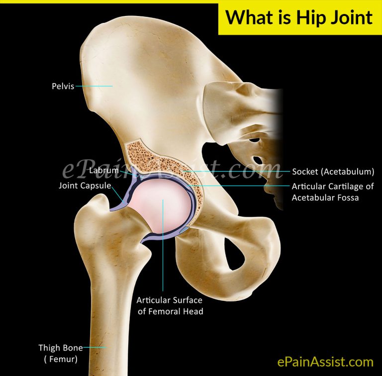 What Causes Hip Joint Pain or Acetabulofemoral Joint Pain?