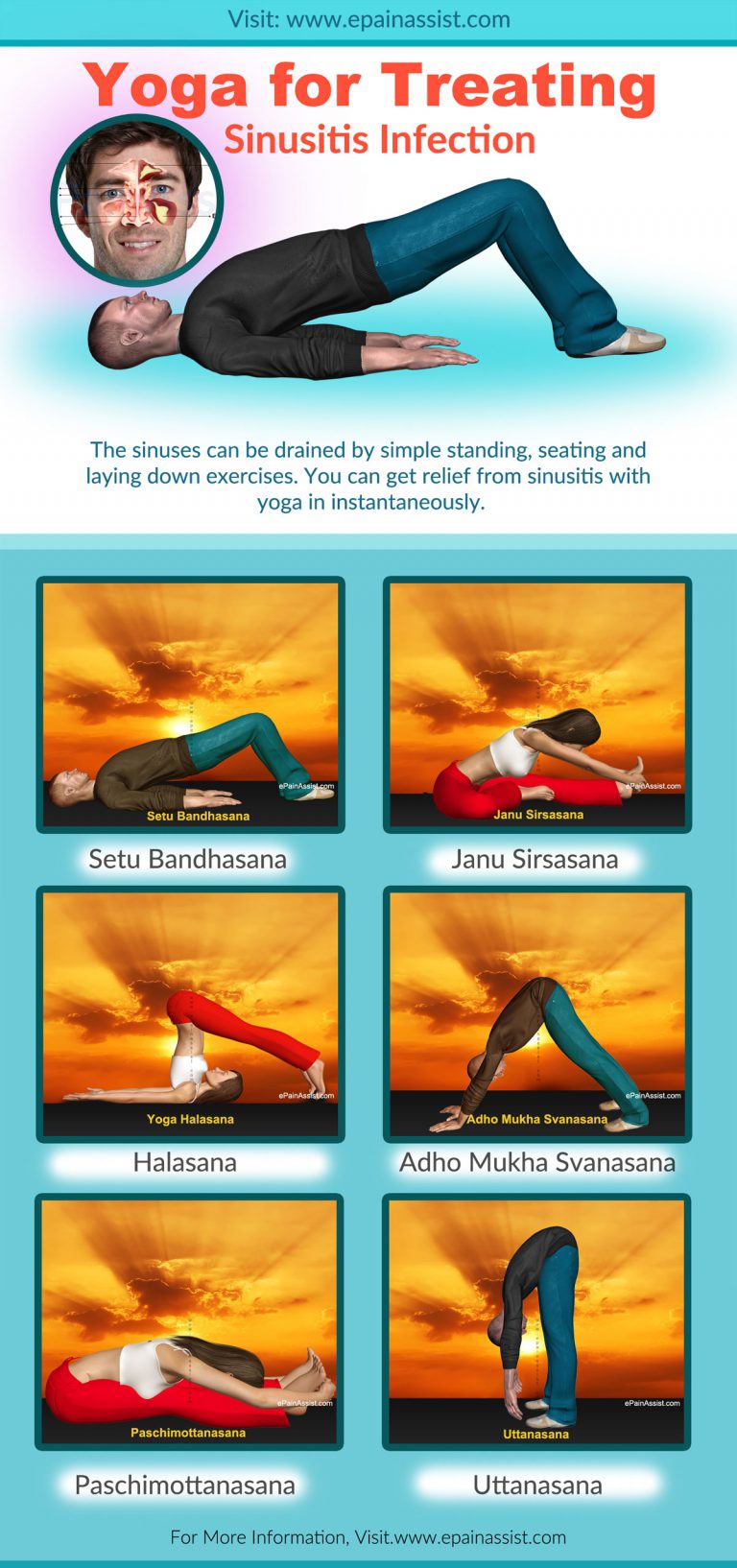 Yoga (Asanas, Kriya, Diet) for Treating Sinusitis Infection