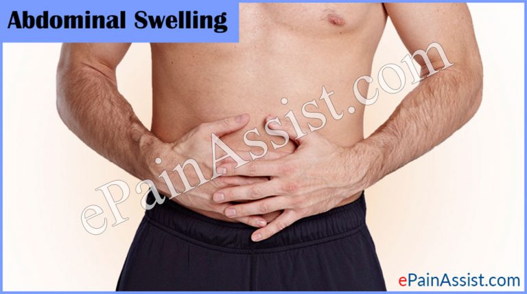 Abdominal Swelling: Causes, Symptoms, Treatment