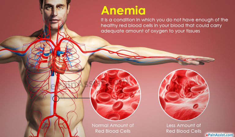 What Causes Anemia and How Can It Be Treated?