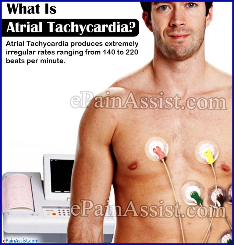 Atrial Tachycardia:  Causes, Symptoms, Diagnosis, Treatment