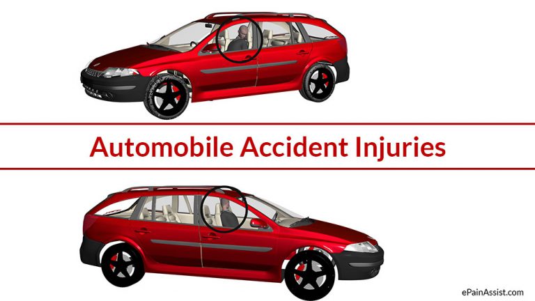 Automobile Accident Injuries: Types of Injury-Mild, Moderate or Severe Injuries, Medical Management of Injuries Following Automobile Accident