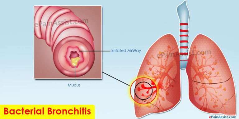 Bacterial Bronchitis: Causes, Symptoms, Risk Factors, Investigations, Treatment, Preventive Therapy