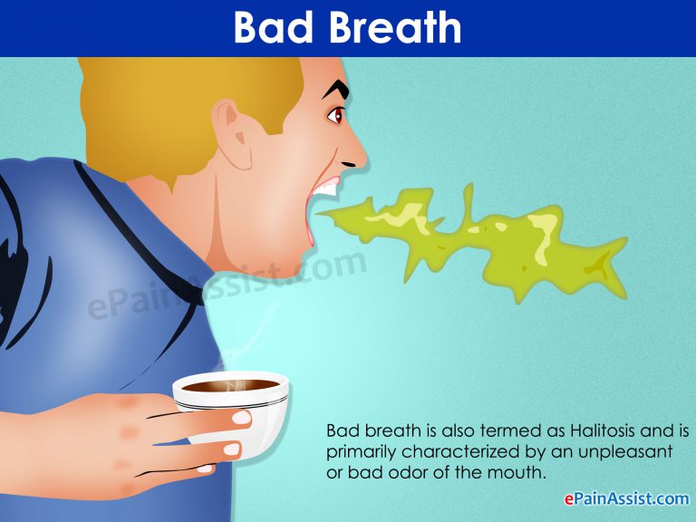 Bad Breath: Facts, Symptoms, Causes, Treatment, Home Remedies, Prevention