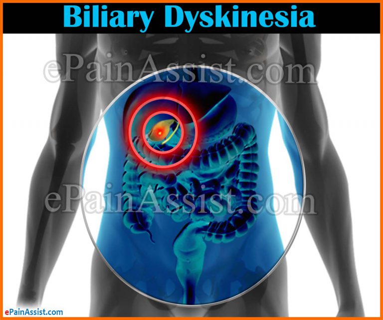 Biliary Dyskinesia: Symptoms, Causes, Treatment, Herbal Remedy