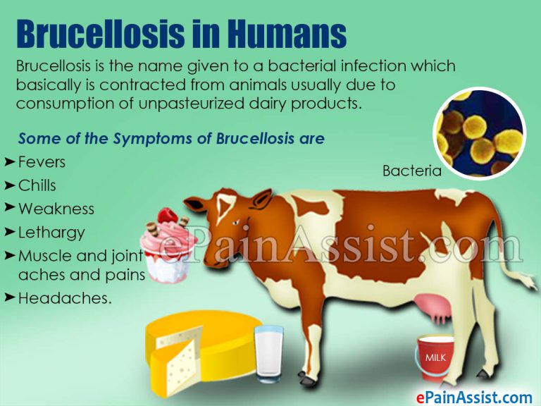 Brucellosis In Humans: Causes, Symptoms, Diagnosis, Treatment