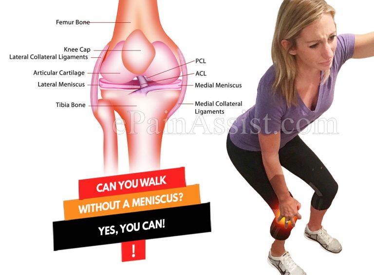 Can You Walk Without A Meniscus? Yes, You Can!