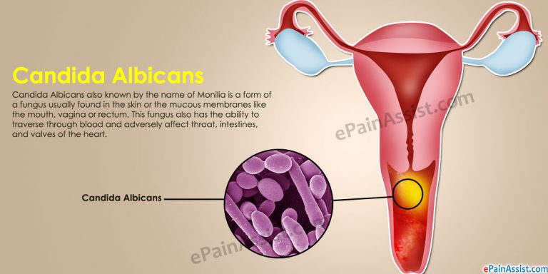 Candida Albicans: Causes, Symptoms, Treatment