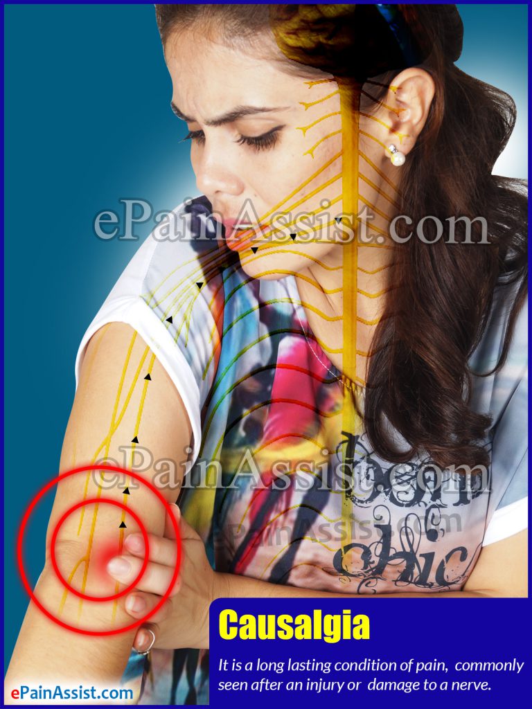 Causalgia: What Can Cause Burning Pain in Arms and Legs?