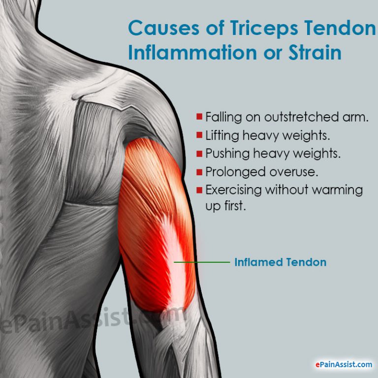 Triceps Tendon Inflammation or Strain: Symptoms, Causes, Treatment- Ultrasound