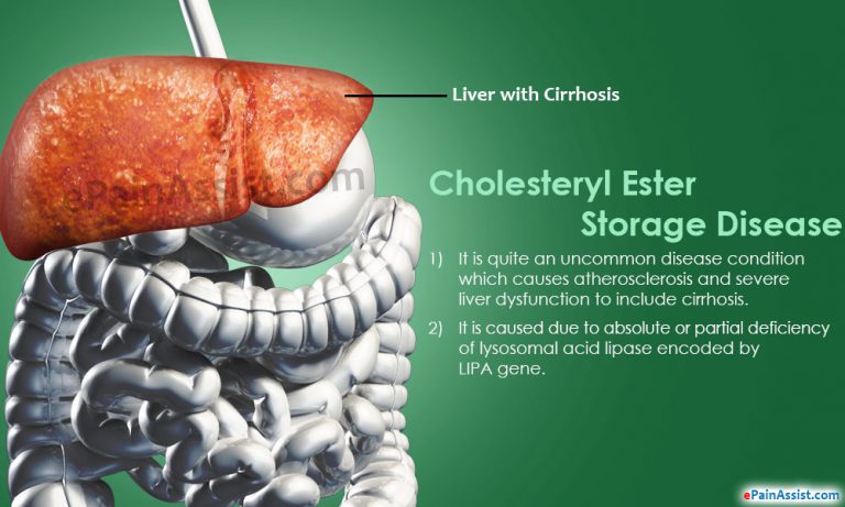 Cholesteryl Ester Storage Disease: Causes, Symptoms, Treatment