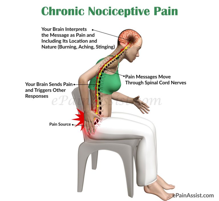 Chronic Nociceptive Pain: Classification, Anatomy, Causes, Risk Factors, Symptoms, Treatment