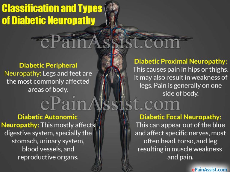 Diabetic Neuropathy: Classification, Types, Causes, Risk Factors, Signs, Symptoms, Treatment