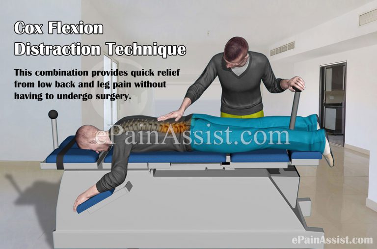 Benefits of Cox Flexion Distraction Technique or Cox Technic