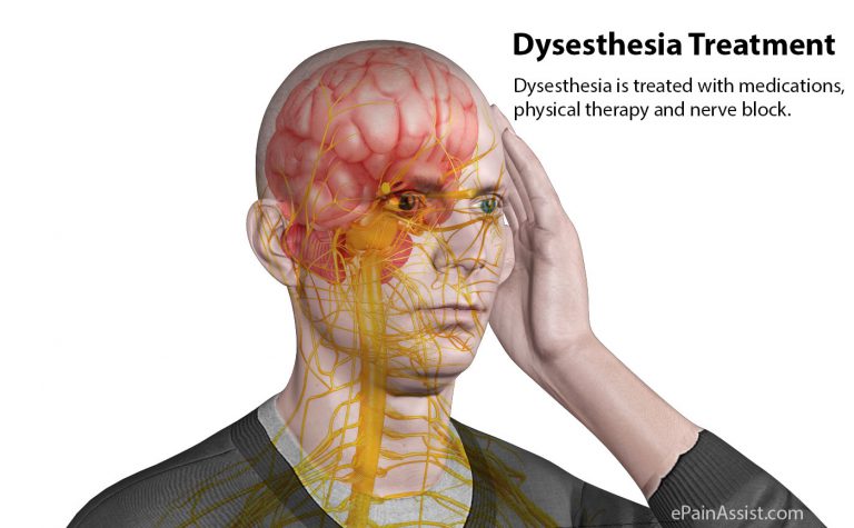 Dysesthesia Treatment Using Oral Pain Medications and Adjuvant Medications