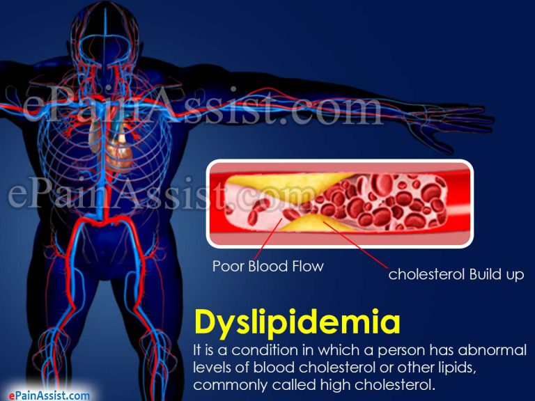 Dyslipidemia: How Does Dyslipidemia Affect Your Health, Causes, Symptoms, Diagnosis, Treatment, Lifestyle Modification