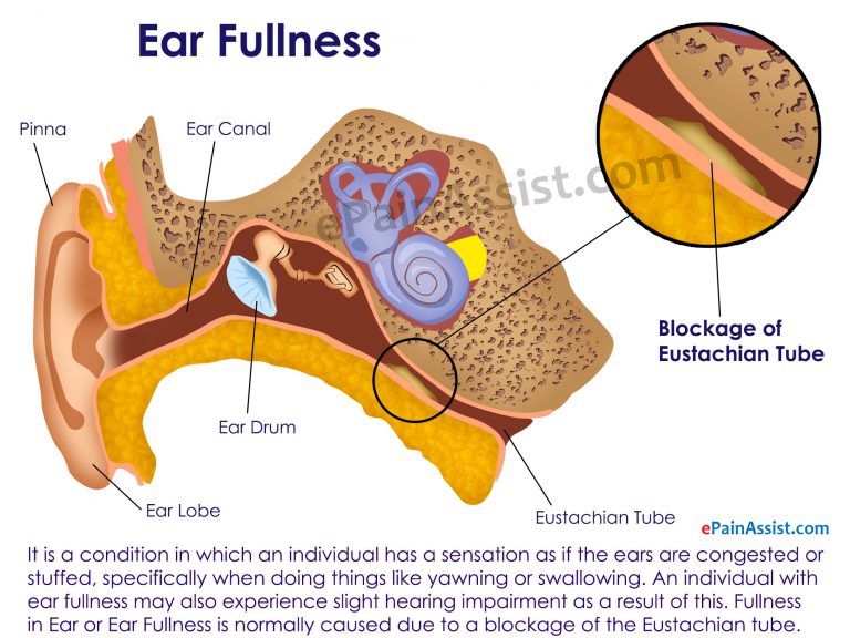 Ear Fullness: Causes, Symptoms, Treatment, Home Remedies