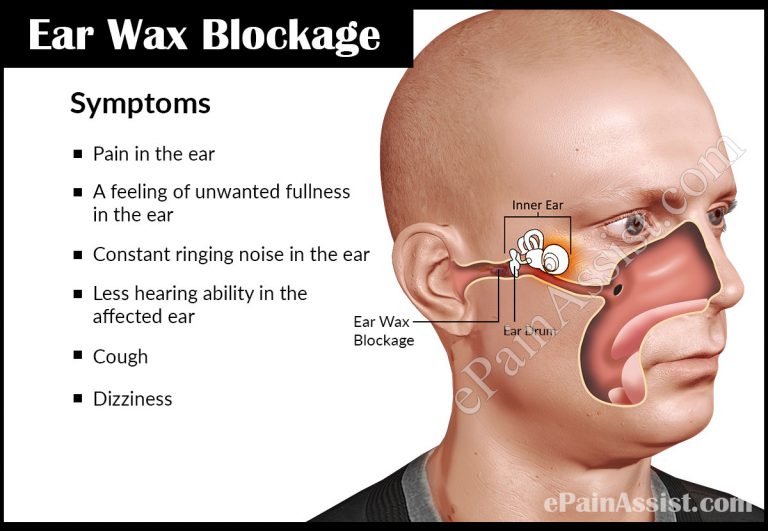 Ear Wax Blockage : Causes, Symptoms, Treatment, Home Remedies
