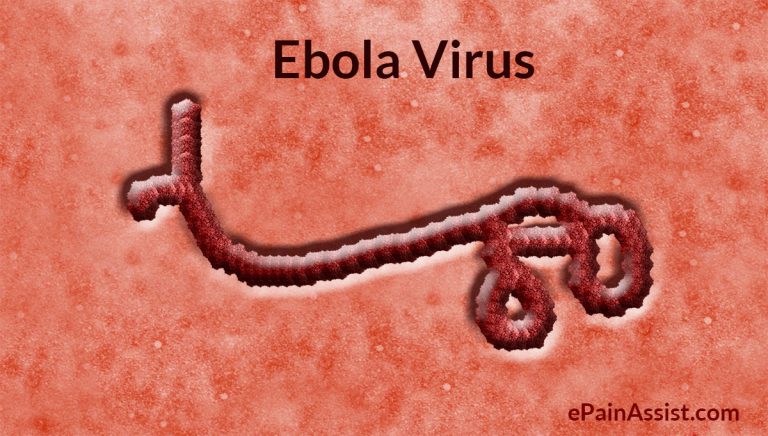What is Ebola Virus? Know The Facts, How Can One Get Infected, Diagnosis, Treatment, Prevention, Its Chances of Spreading in USA