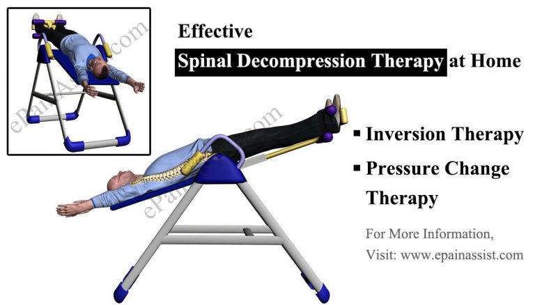 Spinal Decompression at Home: Therapies, Devices, Exercises to Decompress Spine at Home
