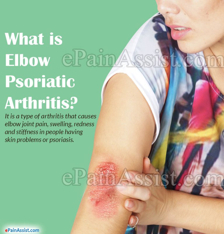 Elbow Psoriatic Arthritis: Types, Causes, Symptoms, Treatment, Prognosis, FAQ