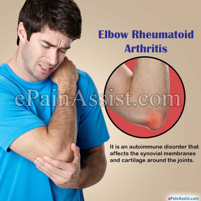 Elbow Rheumatoid Arthritis: Causes, Symptoms, Treatment, Surgery, Physical Therapy, Exercises