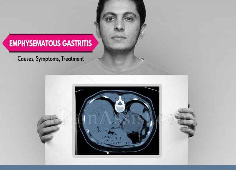 Emphysematous Gastritis-Causes, Symptoms, Diagnosis and Treatment