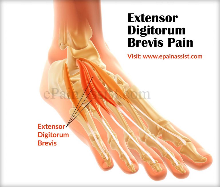 Extensor Digitorum Brevis Pain: Causes, Symptom, Treatment